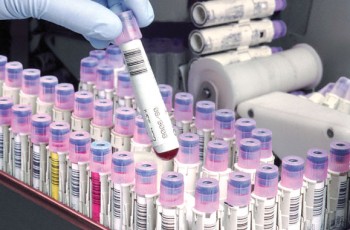 Automated blood testing