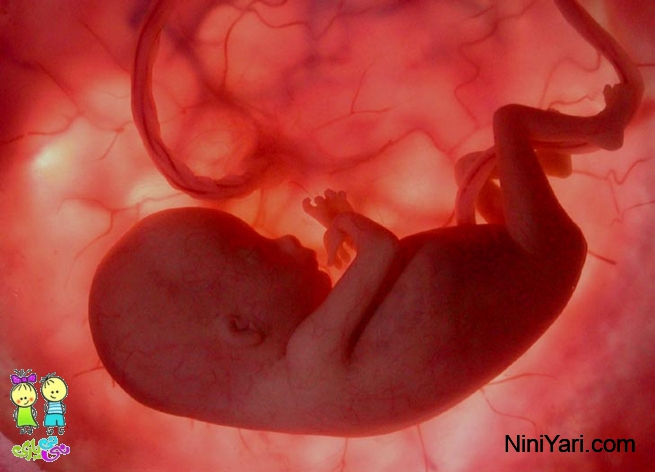 سقط جنین در سه ماه اول بارداری
